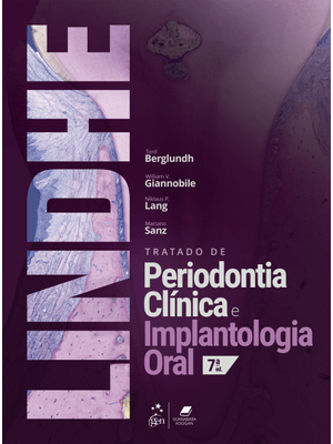 Tratado de Periodontia Clinica e Implantologia Oral