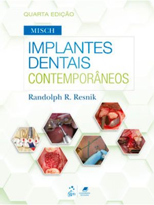 Misch - Implantes Dentais Contemporâneos