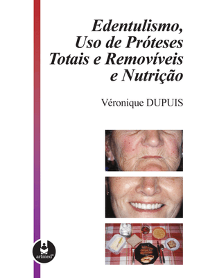 Edentulismo, Uso de Próteses Totais e Removíveis e Nutrição