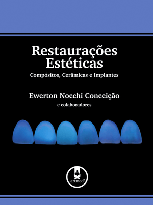 Restaurações Estéticas: Compósitos, Cerâmicas e Implantes