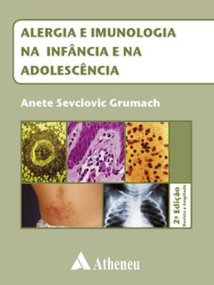 Alergia e Imunologia na Infância e na Adolescência