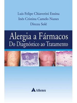 Alergia a Fármacos do Diagnóstico Ao Tratamento