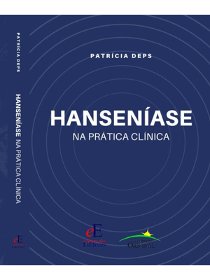 Hanseníase na Prática Clínica
