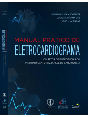 Manual Prático de Eletrocardiograma: do Setor de Emergências do Instituto Dante Pazzanese de Cardiol