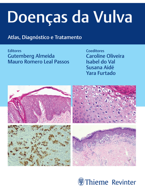 Doenças da Vulva: Atlas, Diagnóstico e Tratamento