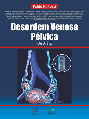 Desordem Venosa Pélvica de a a Z